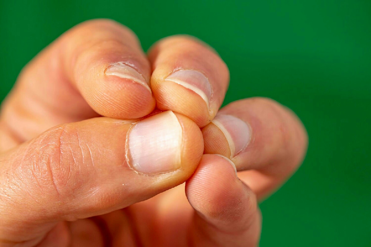 Questo rimedio semplice per unghie rotte aumenta la loro resistenza in pochi minuti